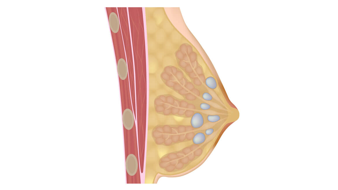 strankycinskemediciny-cysty-a-fibromy-v-prsou