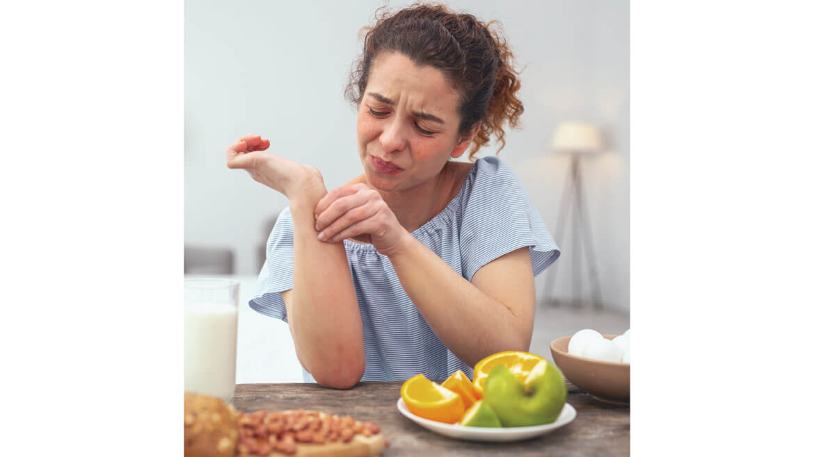 strankycinskemediciny-alergie-na-potraviny