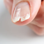 strankycinskemediciny-nehty-lamave