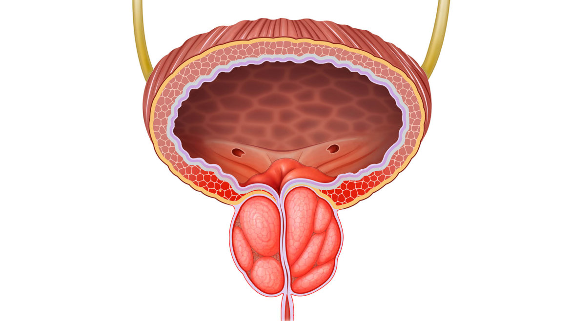 strankycinskemediciny-prostata-zvetsena