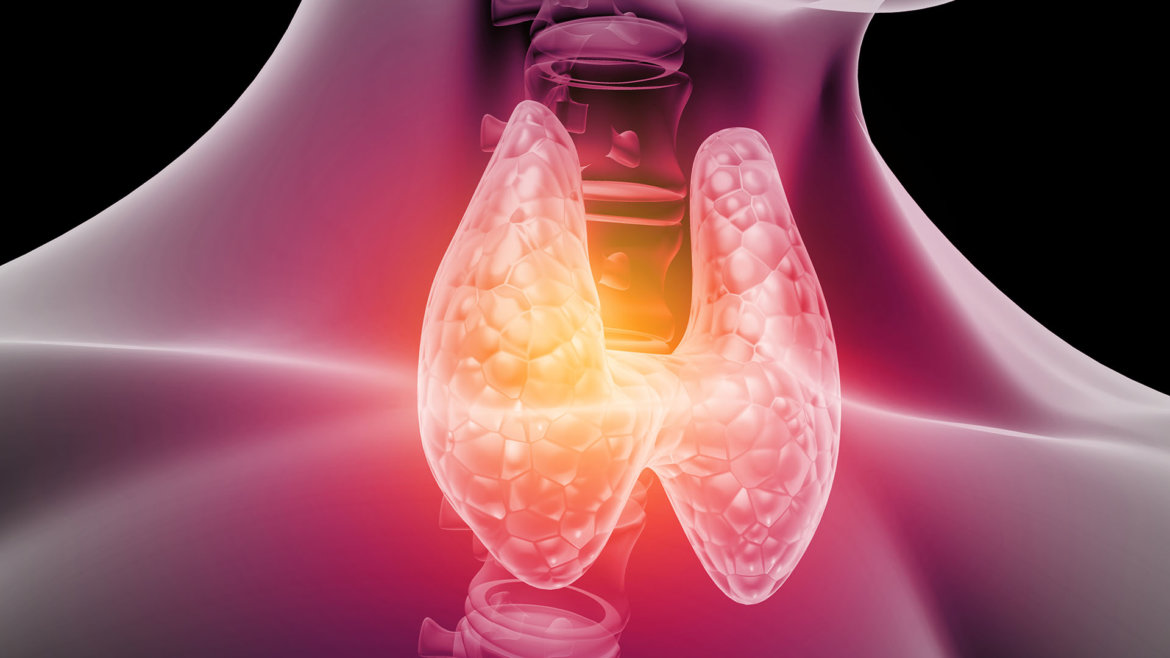 strankycinskemediciny-stitna-zlaza-zvysena-funkce-hyperthyeroza
