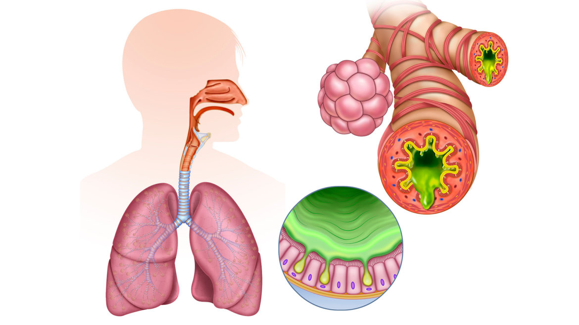 strankycinskemediciny-zahleneni-hlen