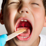 strankycinskemediciny-cepy-na-mandlich