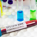 strankycinskemediciny-mononukleoza-eb-viroza