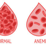 strankycinskemediciny-anemie