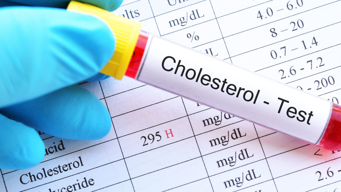 strankycinskemediciny-zvyseny-cholesterol