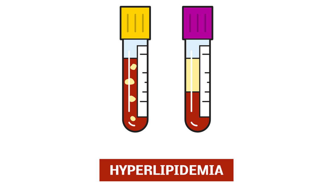 strankycinskemediciny-lipidy-krevníi-zvysene-hyperlipoproteinemie