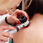 strankycinskemediciny-melanom