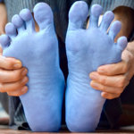 strankycinskemediciny-studene-koncetiny