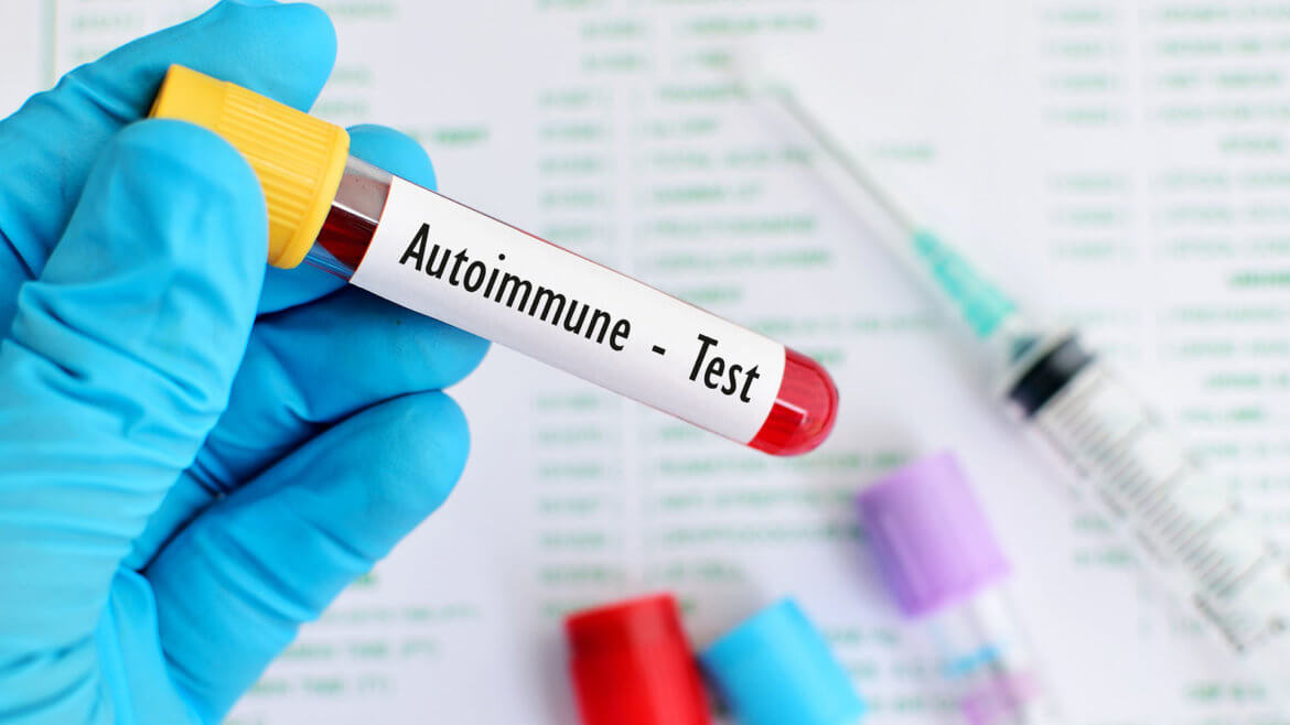 strankycinskemediciny-autoimunitni-choroby