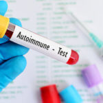 strankycinskemediciny-autoimunitni-choroby