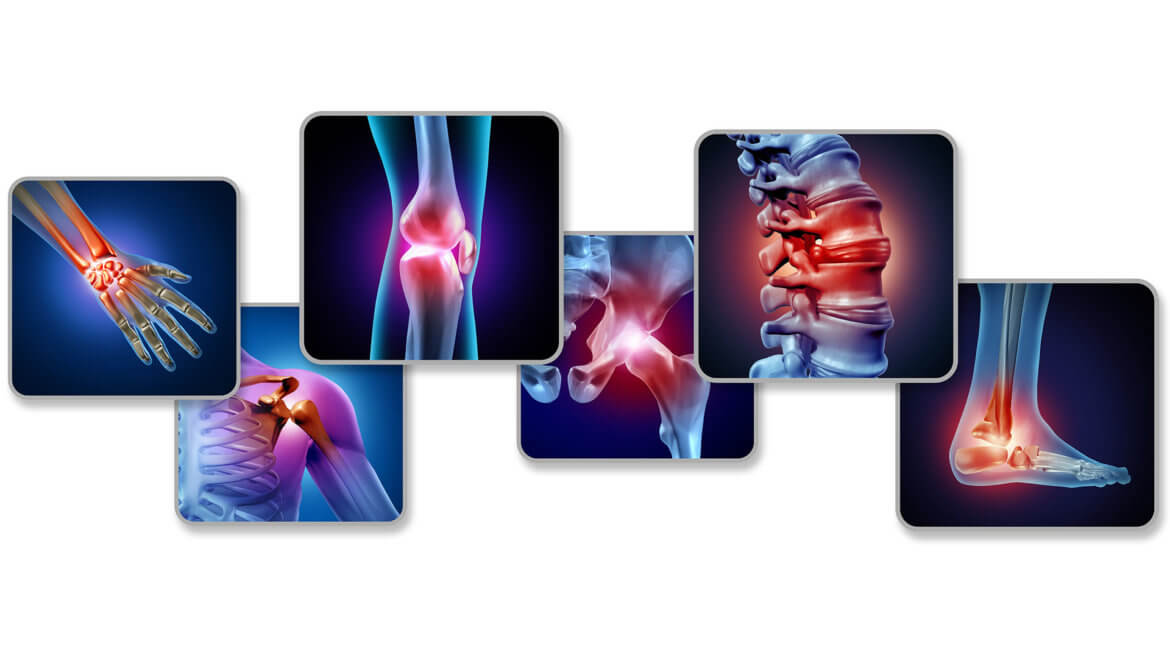 strankycinskemediciny-bolest-pohyboveho-aparatu