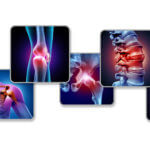 strankycinskemediciny-bolest-pohyboveho-aparatu