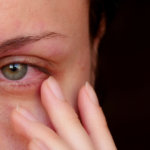 strankycinskemediciny-zanet-oci