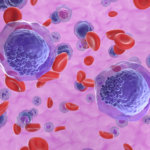 strankycinskemediciny-leukemie