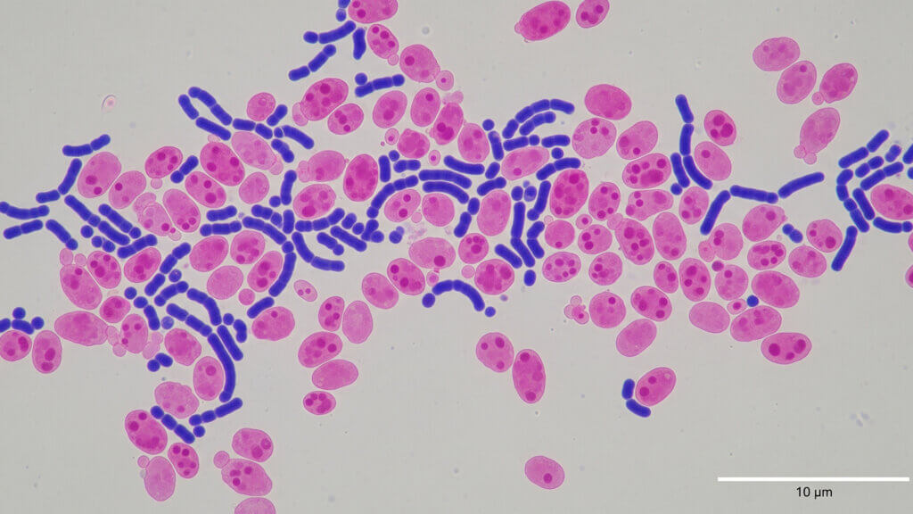 strankycinskemediciny-vaginalni-mikroflora-kvasinky-candida